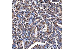 IHC analysis of SERAC1 using anti-SERAC1 antibody (ABIN7602709).