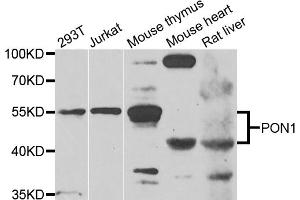 Western blot analysis of extracts of various cell lines, using PON1 antibody (ABIN5975112) at 1/1000 dilution. (PON1 Antikörper)