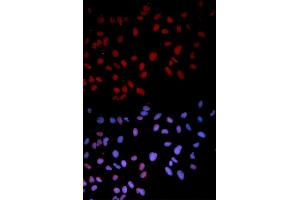 Immunofluorescence analysis of U2OS cells using Phospho-MAPK14-T180 antibody (ABIN5969910). (MAPK14 Antikörper  (pThr180))
