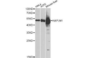 Western blot analysis of extracts of various cell lines, using HAPLN1 antibody (ABIN5973979) at 1/1000 dilution. (HAPLN1 Antikörper)
