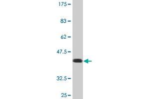 Western Blot detection against Immunogen (35. (USP9X Antikörper  (AA 1-90))