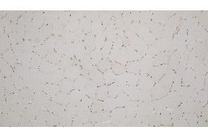 Human skeletal muscle: immunohistochemical staining for Utrophin. (Utrophin Antikörper)
