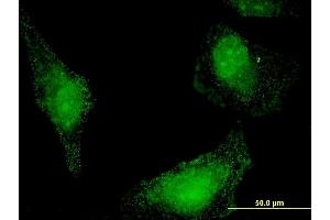 Immunofluorescence of monoclonal antibody to HSPA13 on HeLa cell.