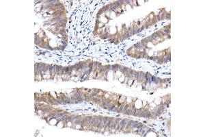 anti-Importin 9 (IPO9) antibody