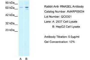 Host: Rabbit Target Name: RNASEL Sample Tissue: Human 293T Whole Cell Antibody Dilution: 1ug/ml (RNASEL Antikörper  (C-Term))