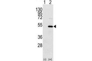 Western Blotting (WB) image for anti-Y Box Binding Protein 1 (YBX1) antibody (ABIN3002604)