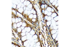 Immunohistochemistry of paraffin-embedded human colon using  Rabbit mAb (ABIN7265740) at dilution of 1:100 (40x lens). (ABCF1 Antikörper)