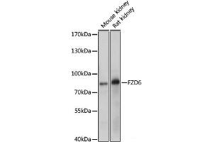 Western blot analysis of extracts of various cell line using FZD6 Polyclonal Antibody at dilution of 1:1000. (FZD6 Antikörper)