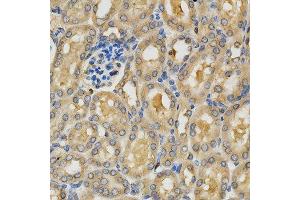 Immunohistochemistry of paraffin-embedded mouse kidney using PLK1 antibody at dilution of 1:200 (x400 lens) (PLK1 Antikörper  (AA 304-603))