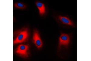 Immunofluorescent analysis of GRP78 staining in HeLa cells. (GRP78 Antikörper  (C-Term))