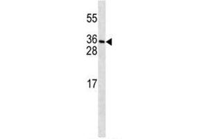 PDGFC antibody western blot analysis in MDA-MB231 lysate. (PDGFC Antikörper  (AA 74-103))