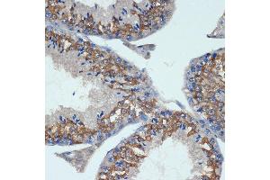 Immunohistochemistry of paraffin-embedded mouse testis using CHMP2B Rabbit mAb (ABIN7266290) at dilution of 1:100 (40x lens). (CHMP2B Antikörper)