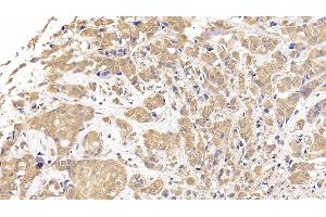 Immunohistochemistry (IHC) image for anti-Ribonucleotide Reductase M1 (RRM1) (AA 1-213) antibody (ABIN7436186)