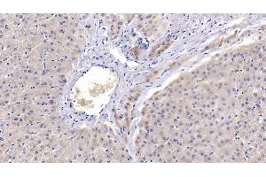 Detection of PRDX3 in Human Liver Tissue using Polyclonal Antibody to Peroxiredoxin 3 (PRDX3) (Peroxiredoxin 3 Antikörper  (AA 5-233))