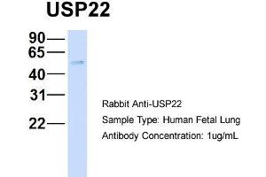 Host: Rabbit   Target Name: USP22   Sample Tissue: Human Fetal Lung  Antibody Dilution: 1. (USP22 Antikörper  (Middle Region))