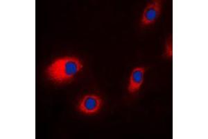 Immunofluorescence (IF) image for anti-Chloride Channel, Voltage-Sensitive 7 (CLCN7) (N-Term) antibody (ABIN7295300)