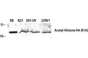 Western Blot (WB) analysis of specific cells using Acetyl-Histone H4 (K16) Polyclonal Antibody.