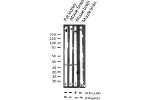 Western blot analysis of Phospho-DARPP-32 (Thr34) expression in various lysates (DARPP32 Antikörper  (pThr34))