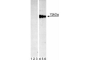 Lysate from control (First Panel) and pervanadate-treated (Second Panel) Ramos cells (Burkitt's lymphoma) were probed with mAb I120-722 at concentrations of 0. (SYK Antikörper  (pTyr348))