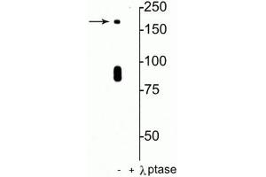 Western blot of rat hippocampal lysate showing specific immunolabeling of the ~180 kDa NR2B subunit of the NMDAR phosphorylated at in the first lane (-). (GRIN2B Antikörper  (pSer1480))