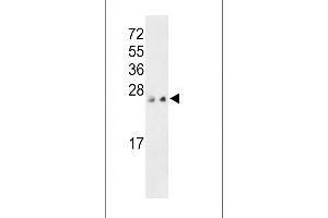 Western blot analysis of PTP4A3 C-term (ABIN392855 and ABIN2842273) in MCF-7 and 293 cell line lysates (35 μg/lane). (PTP4A3 Antikörper  (C-Term))