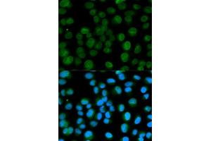 Immunofluorescence analysis of HeLa cell using EMD antibody.