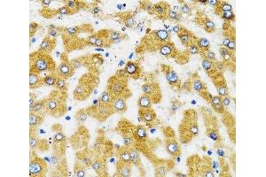 Immunohistochemistry of paraffin-embedded Human liver using SLC27A2 Polyclonal Antibody at dilution of 1:100 (40x lens). (SLC27A2 Antikörper)