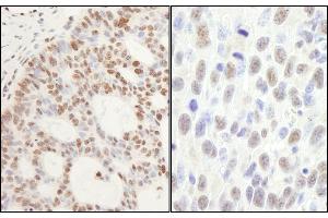Immunohistochemistry (IHC) image for anti-Protein Phosphatase, Mg2+/Mn2+ Dependent, 1G (PPM1G) (AA 400-450) antibody (ABIN7454681)
