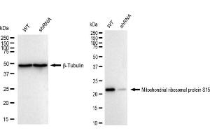 Western blotting analysis using Mitochondrial ribosomal protein S15 antibody (ABIN7799432). (Rekombinanter MRPS15 Antikörper)