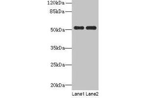 Western blot All lanes: PAH antibody at 2. (Phenylalanine Hydroxylase Antikörper  (AA 2-452))