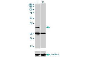 Western blot analysis of STAR over-expressed 293 cell line, cotransfected with STAR Validated Chimera RNAi (Lane 2) or non-transfected control (Lane 1). (STAR Antikörper  (AA 81-180))