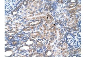 SLC29A2 antibody was used for immunohistochemistry at a concentration of 4-8 ug/ml. (SLC29A2 Antikörper)
