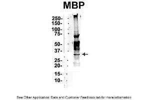 IP Suggested Anti-MBP Antibody Positive Control: NT2 CELL/BRAIN TISSUE (MBP Antikörper  (Middle Region))