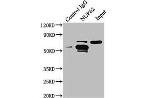 Immunoprecipitating NUP62 in A549 whole cell lysate Lane 1: Rabbit control IgG instead of ABIN7161836 in A549 whole cell lysate. (NUP62 Antikörper  (AA 173-522))