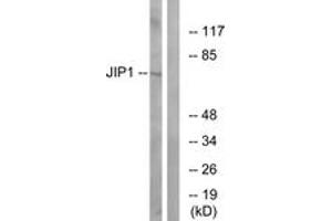 Western blot analysis of extracts from COLO205 cells, treated with Serum 20% 15', using JIP1 (Ab-103) Antibody. (MAPK8IP1 Antikörper  (AA 69-118))