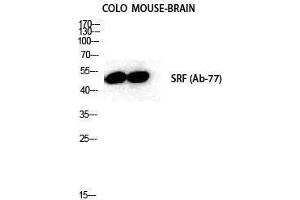 Western Blotting (WB) image for anti-Serum Response Factor (SRF) (Tyr1197) antibody (ABIN3177517) (SRF Antikörper  (Tyr1197))