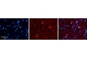 Rabbit Anti-GRP78 Antibody   Formalin Fixed Paraffin Embedded Tissue: Human heart Tissue Observed Staining: Cytoplasmic Primary Antibody Concentration: 1:100 Other Working Concentrations: 1:600 Secondary Antibody: Donkey anti-Rabbit-Cy3 Secondary Antibody Concentration: 1:200 Magnification: 20X Exposure Time: 0.