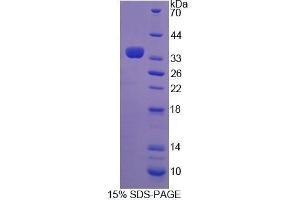 SDS-PAGE (SDS) image for Transglutaminase 3 (E Polypeptide, Protein-Glutamine-gamma-Glutamyltransferase) (TGM3) (AA 468-693) protein (His tag) (ABIN1081017) (TGM3 Protein (AA 468-693) (His tag))