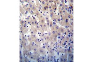 HPRT1 Antibody (N-term) (ABIN652234 and ABIN2840981) immunohistochemistry analysis in formalin fixed and paraffin embedded human liver tissue followed by peroxidase conjugation of the secondary antibody and DAB staining. (HPRT1 Antikörper  (N-Term))