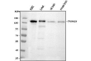 Western blot analysis of TIF1 gamma using anti-TIF1 gamma antibody (ABIN3043492). (TRIM33 Antikörper  (AA 1001-1127))