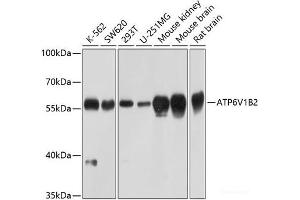Western blot analysis of extracts of various cell lines using ATP6V1B2 Polyclonal Antibody at dilution of 1:1000. (ATP6V1B2 Antikörper)