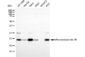 anti-Chromosome 1 Open Reading Frame 93 (C1orf93) antibody