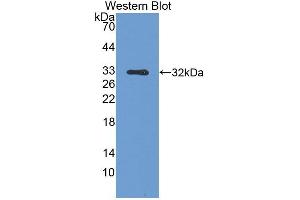 Detection of recombinant SPR using Polyclonal Antibody to Sepiapterin Reductase (SPR) (SPR Antikörper  (AA 1-261))