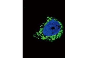 Immunofluorescence (IF) image for anti-Insulin-Like Growth Factor Binding Protein 2, 36kDa (IGFBP2) antibody (ABIN3003819) (IGFBP2 Antikörper)