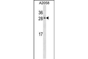 Western blot analysis in A2058 cell line lysates (35ug/lane). (RAB28 Antikörper  (AA 119-147))
