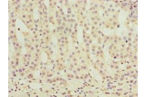 Immunohistochemistry of paraffin-embedded human adrenal gland tissue using ABIN7162175 at dilution of 1:100
