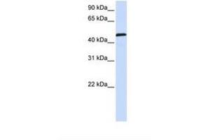 Image no. 1 for anti-Uridine Monophosphate Synthetase (UMPS) (AA 398-447) antibody (ABIN6738421) (UMPS Antikörper  (AA 398-447))