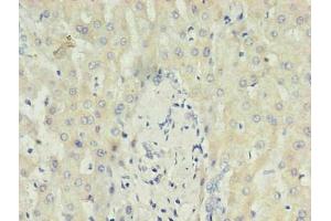 Immunohistochemistry of paraffin-embedded human liver using ABIN7148699 in 30 μg/mL dilute concentrations. (CRP Antikörper)