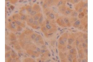 Immunohistochemistry (IHC) image for anti-Tryptase alpha/beta 1 (TPSAB1) (AA 161-262) antibody (ABIN7433105)