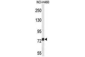 Western blot analysis of CHAT Antibody (N-term) in NCI-H460 cell line lysates (35µg/lane). (Choline Acetyltransferase Antikörper  (N-Term))